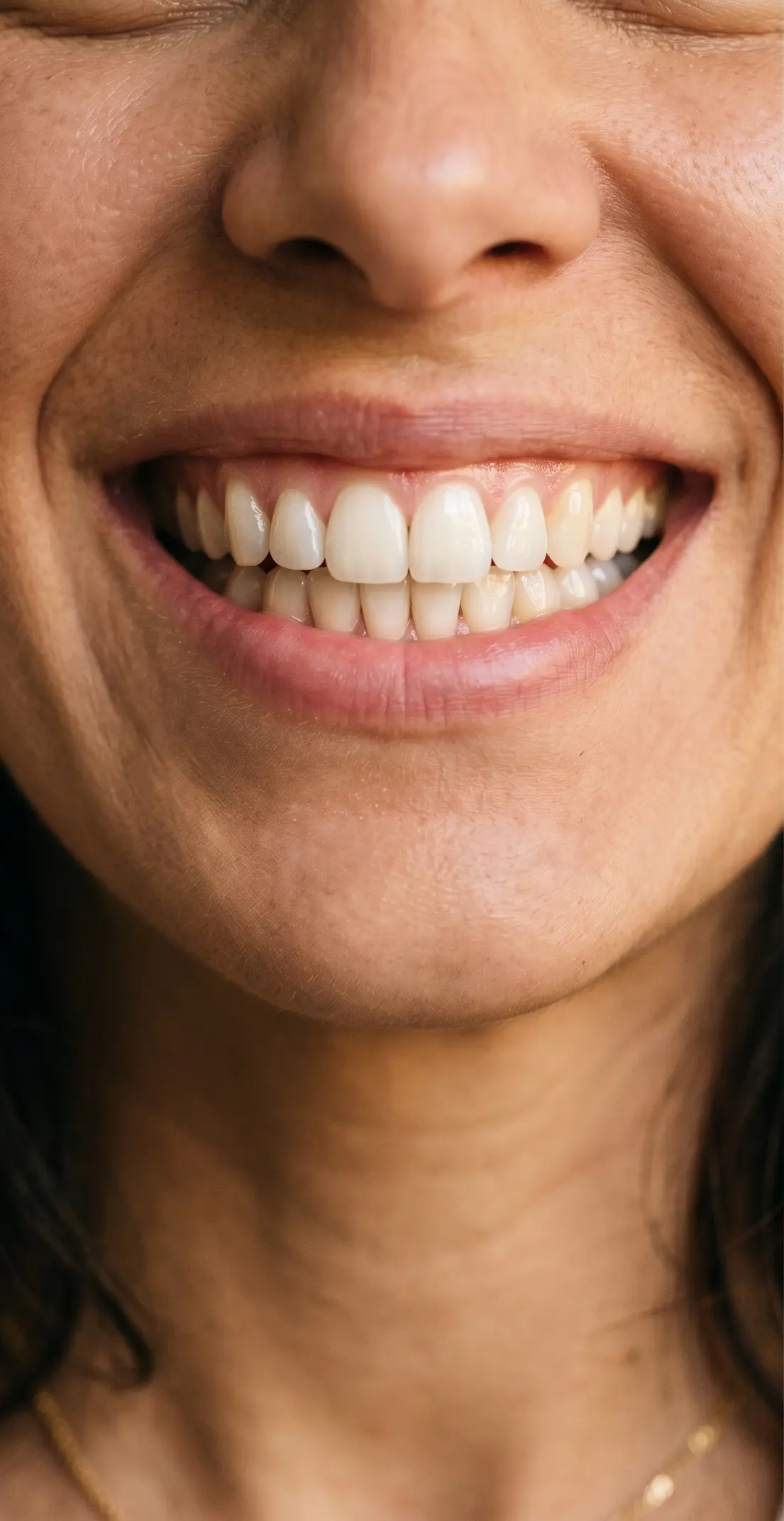 Resultado estético de implante dental en Velia Clínica Dental — sonrisa natural perfecta